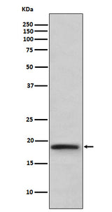 Anti-TNF beta Rabbit Monoclonal Antibody Boster Bio