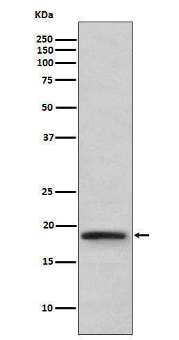 Anti-TNF beta Rabbit Monoclonal Antibody Boster Bio