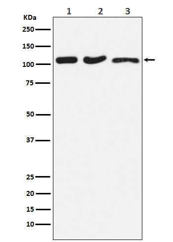 Anti-DISC1 Rabbit Monoclonal Antibody Boster Bio