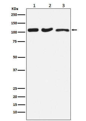 Anti-DISC1 Rabbit Monoclonal Antibody Boster Bio