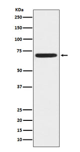 Anti-ZAP70 Monoclonal Antibody Boster Bio