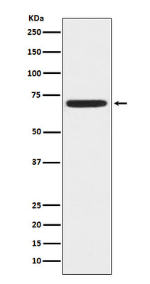 Anti-ZAP70 Monoclonal Antibody Boster Bio