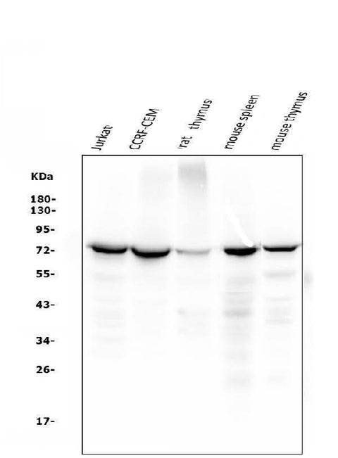 Anti-ZAP70 Antibody Picoband® (monoclonal, 9D5 Boster Bio