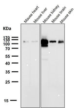 Anti-ACE2 Rabbit Monoclonal Antibody Boster Bio