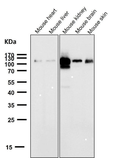 Anti-ACE2 Rabbit Monoclonal Antibody Boster Bio