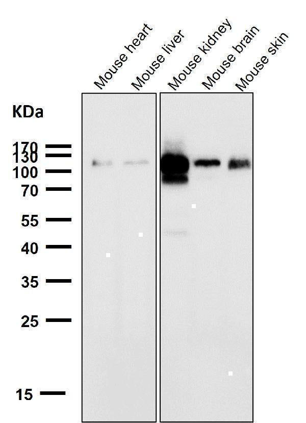 Anti-ACE2 Rabbit Monoclonal Antibody Boster Bio