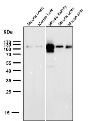 Anti-ACE2 Rabbit Monoclonal Antibody Boster Bio