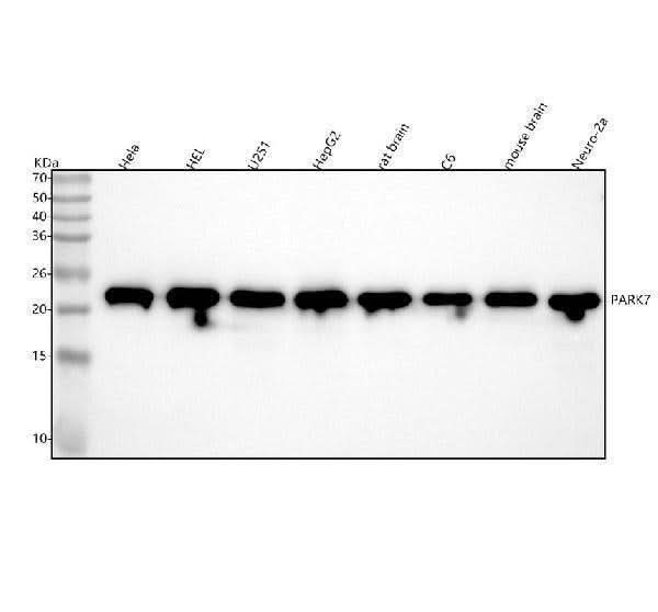 Anti-PARK7/Dj 1 Rabbit Monoclonal Antibody Boster Bio