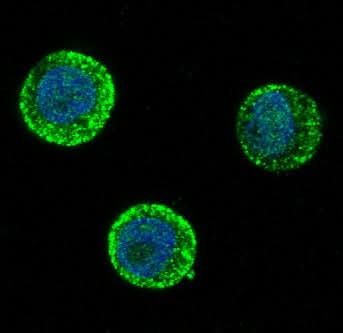 Anti-SOX10 Rabbit Monoclonal Antibody Boster Bio