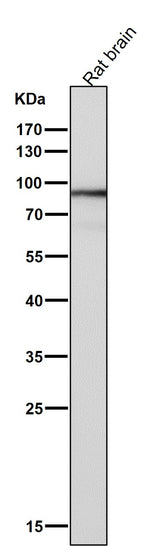 Anti-SOX10 Rabbit Monoclonal Antibody Boster Bio