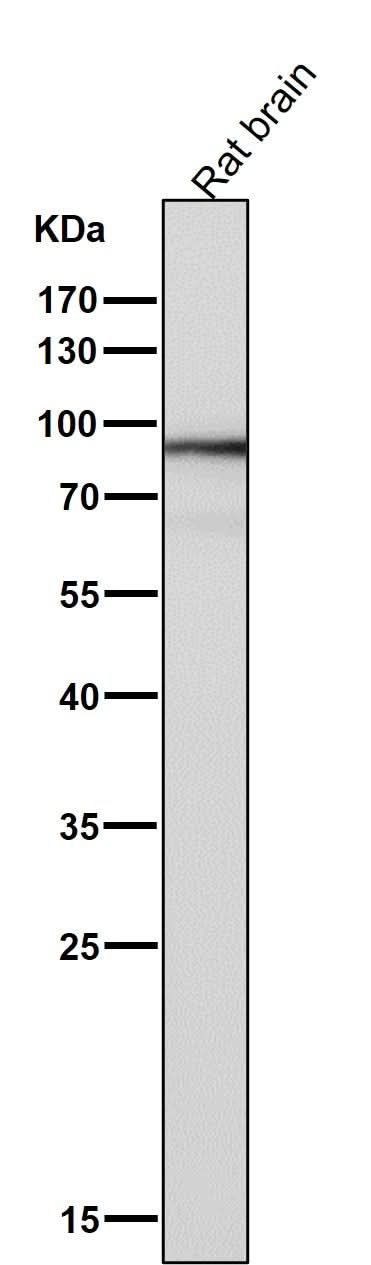 Anti-SOX10 Rabbit Monoclonal Antibody Boster Bio