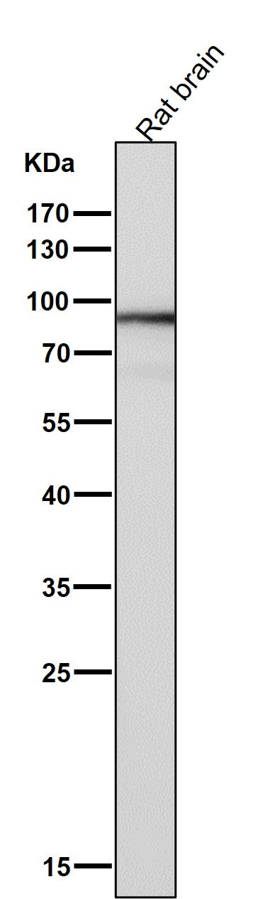 Anti-SOX10 Rabbit Monoclonal Antibody Boster Bio
