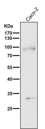 Anti-TGF beta Receptor II TGFBR2 Rabbit Monoclonal Antibody Boster Bio