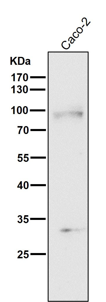 Anti-TGF beta Receptor II TGFBR2 Rabbit Monoclonal Antibody Boster Bio