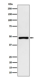 Anti-PAH Rabbit Monoclonal Antibody Boster Bio