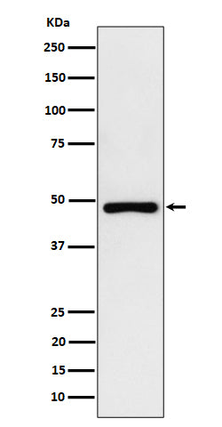 Anti-PAH Rabbit Monoclonal Antibody Boster Bio
