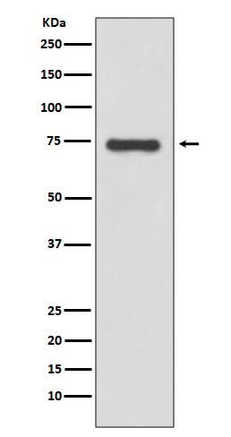 Anti-Moesin Rabbit Monoclonal Antibody Boster Bio