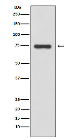 Anti-Moesin Rabbit Monoclonal Antibody Boster Bio