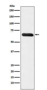 Anti-RBPJK Monoclonal Antibody Boster Bio