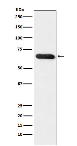 Anti-RBPJK Monoclonal Antibody Boster Bio