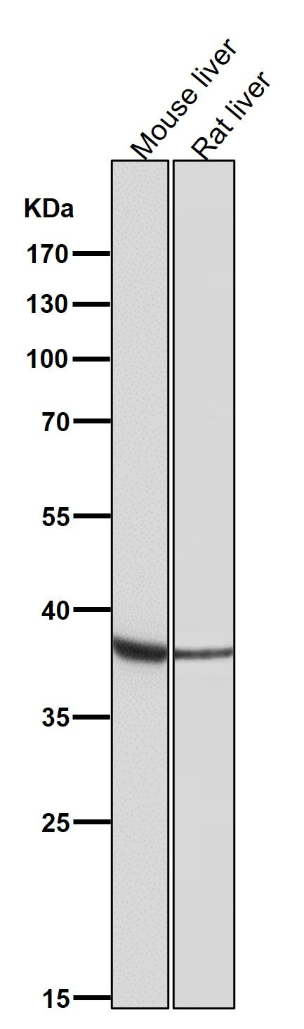 Anti-OGG1 Rabbit Monoclonal Antibody Boster Bio