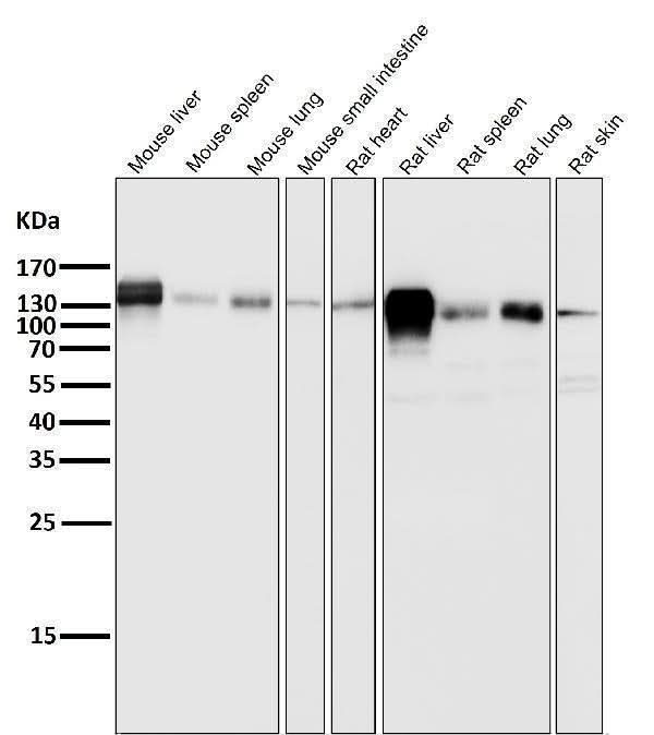 Anti-Integrin beta 1 ITGB1 Rabbit Monoclonal Antibody Boster Bio