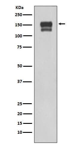 Anti-Integrin beta 1 ITGB1 Rabbit Monoclonal Antibody Boster Bio