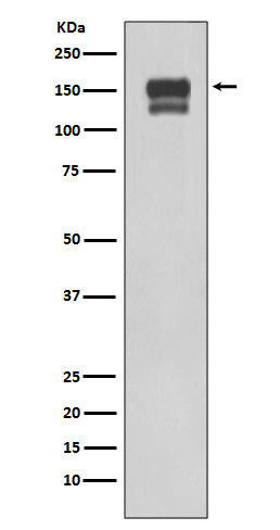 Anti-Integrin beta 1 ITGB1 Rabbit Monoclonal Antibody Boster Bio