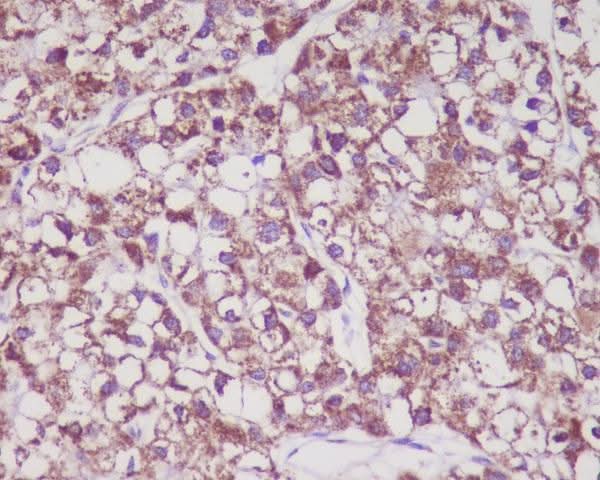Anti-MMP3 Rabbit Monoclonal Antibody Boster Bio