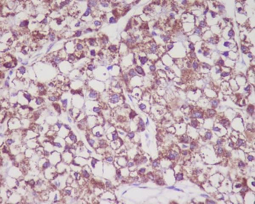 Anti-MMP3 Rabbit Monoclonal Antibody Boster Bio