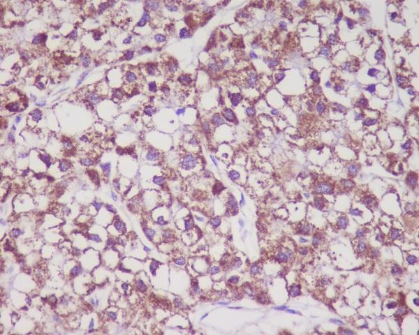 Anti-MMP3 Rabbit Monoclonal Antibody Boster Bio