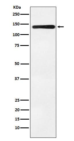 Anti-Bub1 Rabbit Monoclonal Antibody Boster Bio