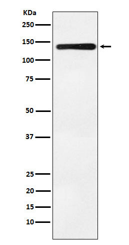 Anti-Bub1 Rabbit Monoclonal Antibody Boster Bio