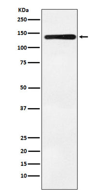 Anti-Bub1 Rabbit Monoclonal Antibody Boster Bio