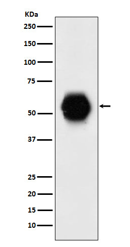 Anti-Gata6 Rabbit Monoclonal Antibody Boster Bio
