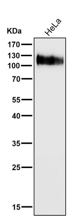 Anti-LAMP1/Cd107A Rabbit Monoclonal Antibody Boster Bio
