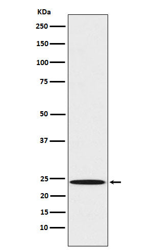 Anti-Mad2L1 Rabbit Monoclonal Antibody Boster Bio