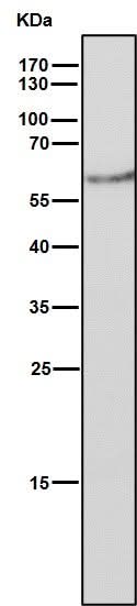 Anti-Estrogen Receptor beta ESR2 Rabbit Monoclonal Antibody Boster Bio