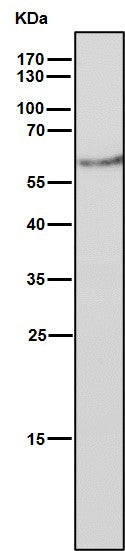 Anti-Estrogen Receptor beta ESR2 Rabbit Monoclonal Antibody Boster Bio