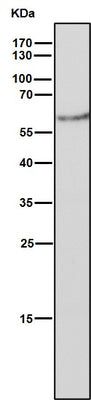 Anti-Estrogen Receptor beta ESR2 Rabbit Monoclonal Antibody Boster Bio