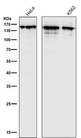 Anti-Collagen III Rabbit Monoclonal Antibody Boster Bio
