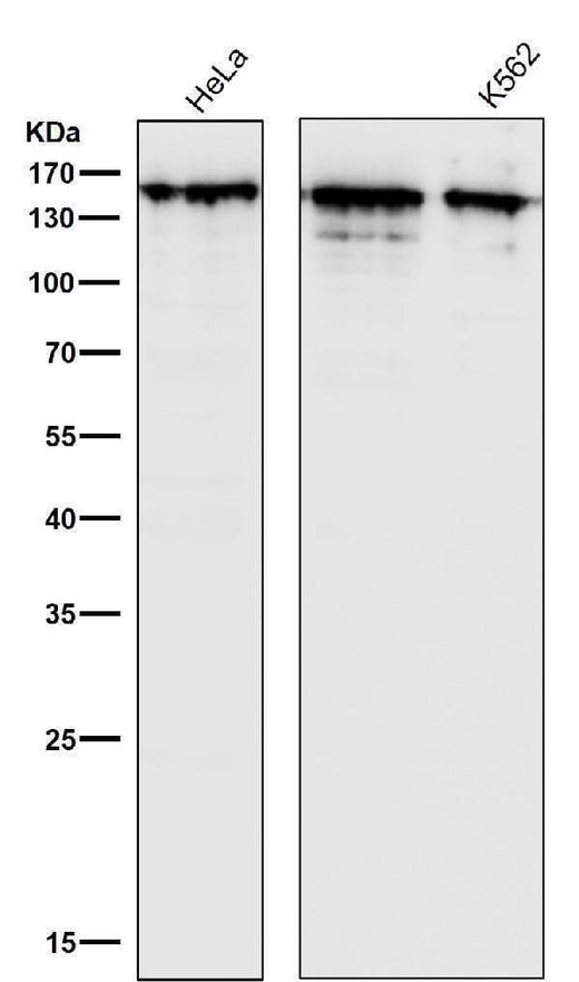 Anti-Collagen III Rabbit Monoclonal Antibody Boster Bio