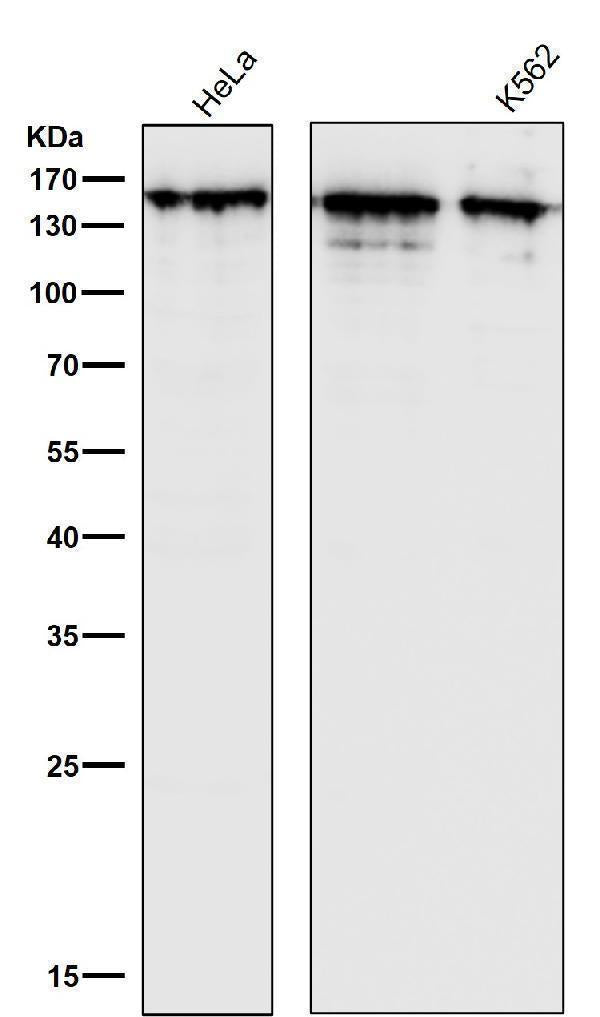 Anti-Collagen III Rabbit Monoclonal Antibody Boster Bio