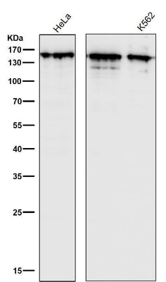 Anti-Collagen III Rabbit Monoclonal Antibody Boster Bio