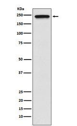 Anti-TRPM7 Monoclonal Antibody Boster Bio