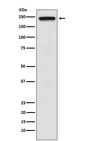 Anti-TRPM7 Monoclonal Antibody Boster Bio