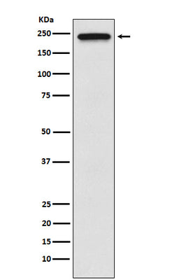 Anti-TRPM7 Monoclonal Antibody Boster Bio