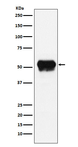 Anti-Fibrinogen gamma chain Rabbit Monoclonal Antibody Boster Bio