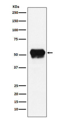 Anti-Fibrinogen gamma chain Rabbit Monoclonal Antibody Boster Bio