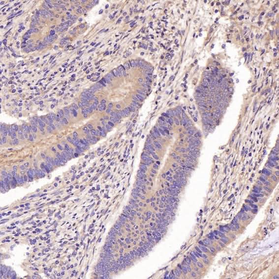 Anti-GSK3 beta Rabbit Monoclonal Antibody Boster Bio